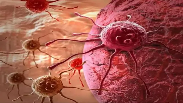 cancer-1785206523368_v